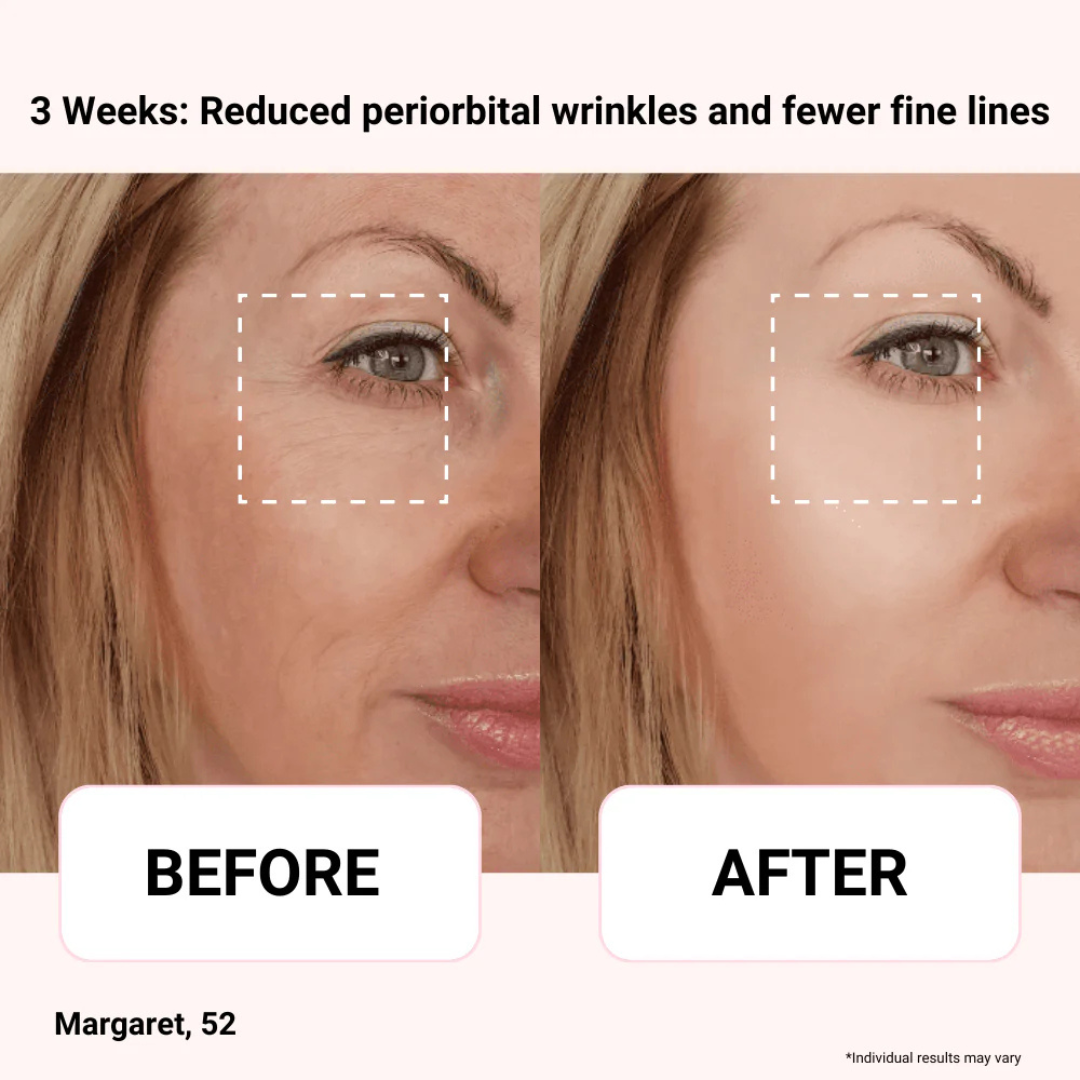 Axis‑Y Vegan Collagen Eye Serum | 100% Authentic Korean Eye Serum