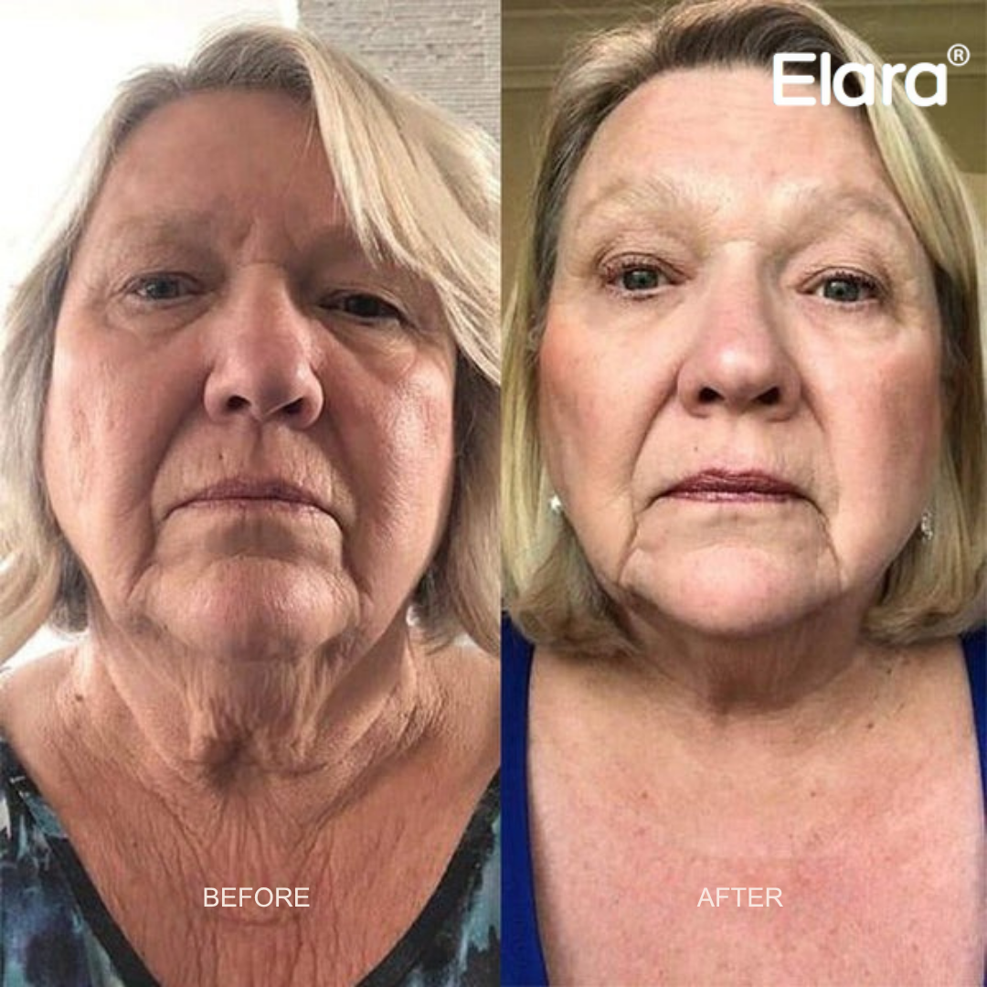 VT COSMETICS® | CICA Reedle Shot 100 Essence