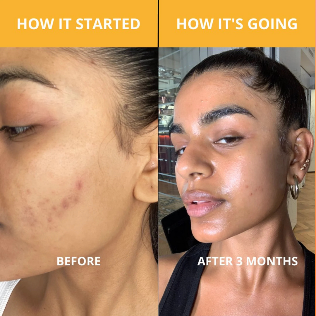 Dr.Melaxin® Peel Shot | Exfoliating Kojic Acid Turmeric Spray 200ml