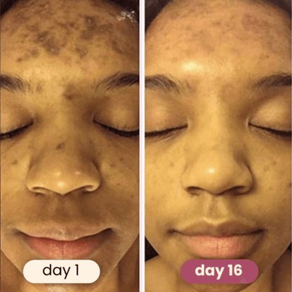 Elara™ Premimum Kojic Acid Turmeric Cleansing Pads