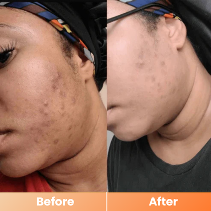 Dr.Melaxin® Peel Shot | Exfoliating Kojic Acid Turmeric Spray 200ml