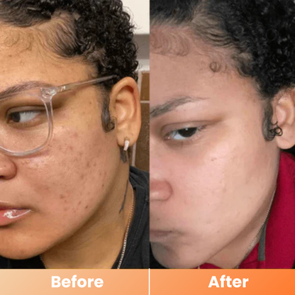 Dr.Melaxin® Peel Shot | Exfoliating Kojic Acid Turmeric Spray 200ml