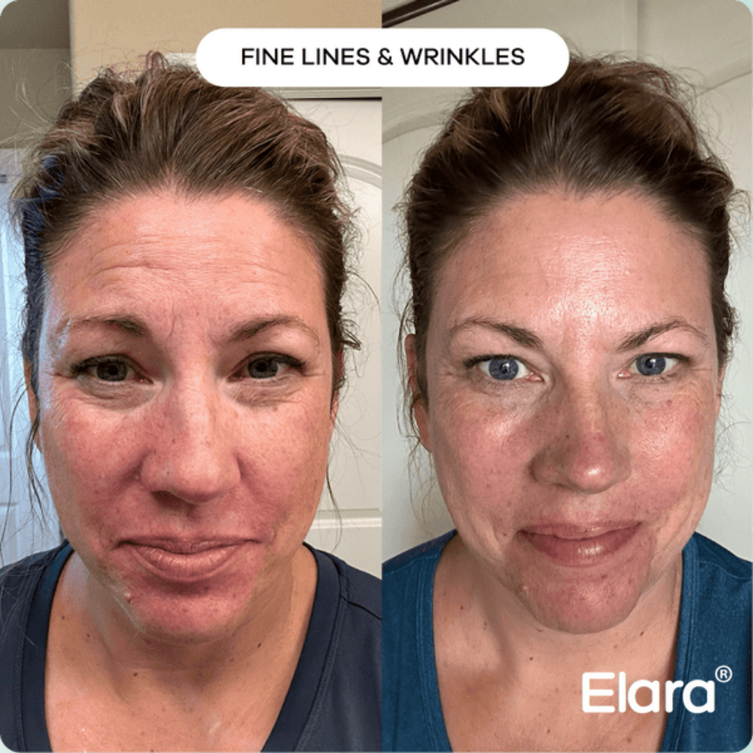 VT COSMETICS® | CICA Reedle Shot 100 Essence