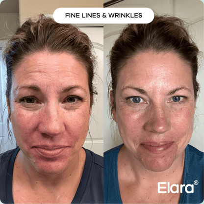 VT COSMETICS® | CICA Reedle Shot 100 Essence