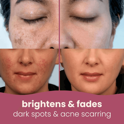 Elara™ Premimum Kojic Acid Turmeric Cleansing Pads