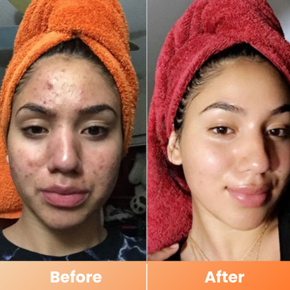 Dr.Melaxin® Peel Shot | Exfoliating Kojic Acid Turmeric Spray 200ml