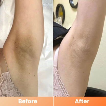 Dr.Melaxin® Peel Shot | Exfoliating Kojic Acid Turmeric Spray 200ml