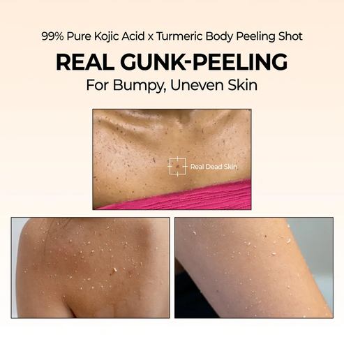 Dr.Melaxin® Peel Shot | Exfoliating Kojic Acid Turmeric Spray 200ml